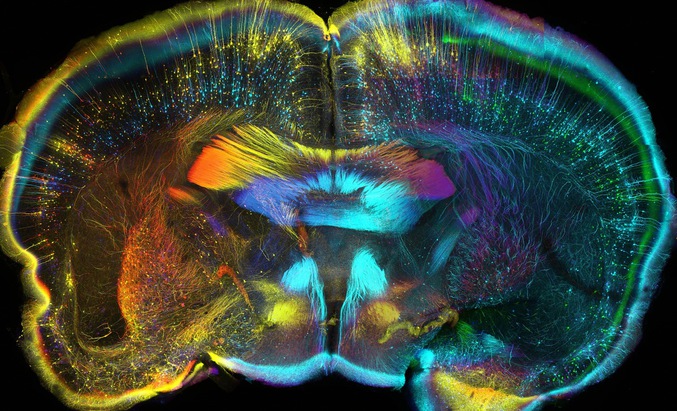 Plan de coupe du cerveau d'une souris