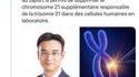 Des chercheurs japonais ont réussi à éliminer le chromosome 21 dans des cellules humaines