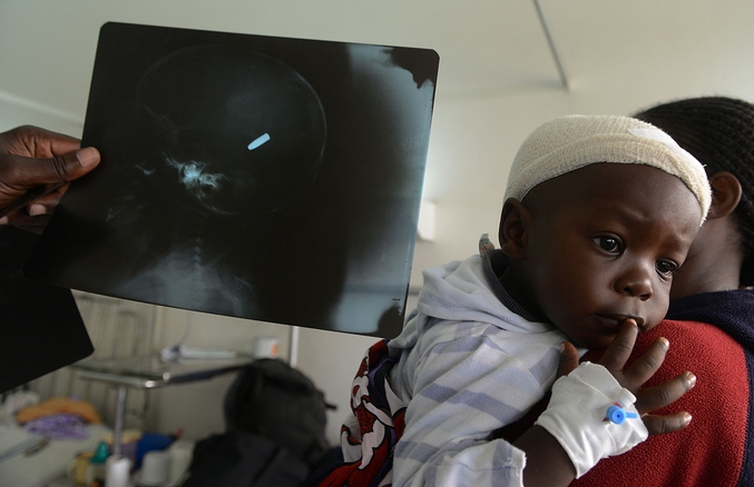 Un médecin tient une radio qui montre qu’une balle est venue se loger dans la tête d’un garçon de 18 mois, Satrin, alors qu’il a reçu des soins pour calmer la douleur. Un peu plus tôt, des hommes armés ont tiré lors d’un rassemblement religieux dans la ville de Mombasa. Les médecins vont devoir attendre environ deux semaines pour que le gonflement se réduise avant d’intervenir. (Simon Maina pour l'AFP)