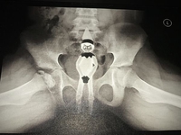 Le cadeau dans la hotte