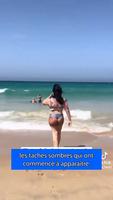 BBL : Implants fessier 