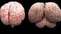 Cerveau d'humain et de dauphin