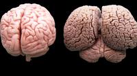 Cerveau d'humain et de dauphin