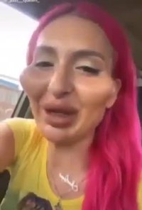 Chirurgie 