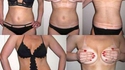 La trace du maillot