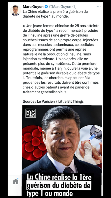 Si cette annonce venue de Chine venait à être confirmée scientifiquement et reproduite à plus grande échelle, elle représenterait une avancée médicale majeure. Le diabète de type 1 est une maladie auto-immune chronique dans laquelle le système immunitaire détruit les cellules bêta du pancréas, responsables de la production d’insuline. Jusqu’à présent, aucun traitement ne permettait de rétablir cette production naturelle de façon durable. Les malades de type 1 doivent donc s’injecter de l’insuline à vie, plusieurs fois par jour, sous peine de complications graves, voire mortelles.

Dans le cas rapporté ici, une jeune femme chinoise de 25 ans aurait recommencé à produire de l’insuline naturellement après une greffe autologue de cellules souches, c’est-à-dire des cellules issues de son propre corps. Plus précisément, des cellules adultes ont été prélevées, probablement dans la moelle osseuse ou les tissus adipeux, puis reprogrammées génétiquement pour devenir des cellules similaires aux cellules bêta pancréatiques. Ces cellules ont ensuite été injectées dans ses muscles abdominaux, où elles se sont mises à produire de l’insuline de façon autonome. Ce type de greffe présente plusieurs avantages : elle limite les risques de rejet immunitaire puisque les cellules sont issues du corps du patient, et elle évite le recours à une greffe pancréatique lourde ou à des traitements immunosuppresseurs. Un an après l’opération, la patiente ne présenterait plus aucun symptôme du diabète, ni besoin d’injections.

Cependant, des réserves s’imposent. D’abord, il s’agit d’un seul cas, ce qui empêche toute généralisation. Les chercheurs eux-mêmes appellent à la prudence : il faut confirmer ces résultats chez un grand nombre de patients pour s’assurer de la fiabilité, de la sécurité et de la reproductibilité de la méthode. Ensuite, rien ne garantit que la production d’insuline restera stable sur le long terme. Il existe aussi un risque, même faible, que les cellules greffées dérivent et deviennent tumorales. Enfin, il est possible que la réponse auto-immune initiale se réactive un jour contre les nouvelles cellules productrices d’insuline.

L’enjeu est immense. En France, environ 4 millions de personnes vivent avec un diabète, dont environ 400 000 atteints de diabète de type 1. Le reste, soit près de 90 %, souffrent du diabète de type 2, lié principalement à l’âge, à l’alimentation, au surpoids et à la sédentarité. Le diabète de type 2 peut parfois être réversible, notamment par des changements drastiques de mode de vie, mais dans de nombreux cas, il nécessite aussi des traitements médicamenteux voire de l’insuline. Le coût humain et économique du diabète est considérable : complications cardiovasculaires, amputations, cécité, insuffisance rénale, sans compter l’impact psychologique.

Dans le monde, plus de 530 millions de personnes sont diabétiques, dont environ 9 millions avec un diabète de type 1. Le diabète est désormais considéré comme l’une des grandes pandémies silencieuses du XXIe siècle, avec une progression fulgurante, notamment dans les pays à revenu intermédiaire. Si cette thérapie cellulaire pouvait être confirmée, adaptée et rendue accessible, elle ouvrirait une voie inédite vers une véritable guérison du diabète de type 1, là où la médecine s’était jusqu’ici limitée à le gérer. Cela marquerait un tournant historique dans la lutte contre une maladie qui, bien que moins fréquente que le type 2, reste l’une des plus contraignantes à vivre au quotidien.

En supposant que les premiers résultats soient rapidement validés par des essais cliniques à plus grande échelle, que la méthode reste sûre, efficace et reproductible, et que les autorités sanitaires donnent leur feu vert, il faudrait en moyenne entre 7 et 10 ans pour qu’un tel traitement soit diffusé au grand public. Ce délai comprend les essais cliniques sur plusieurs centaines de patients, les procédures de validation réglementaire, la production à échelle industrielle, la formation des équipes médicales et l’organisation logistique. Dans un scénario optimiste, certains centres spécialisés pourraient commencer à le proposer à petite échelle dans 5 ans, mais une généralisation mondiale prendra probablement une décennie, voire plus.
