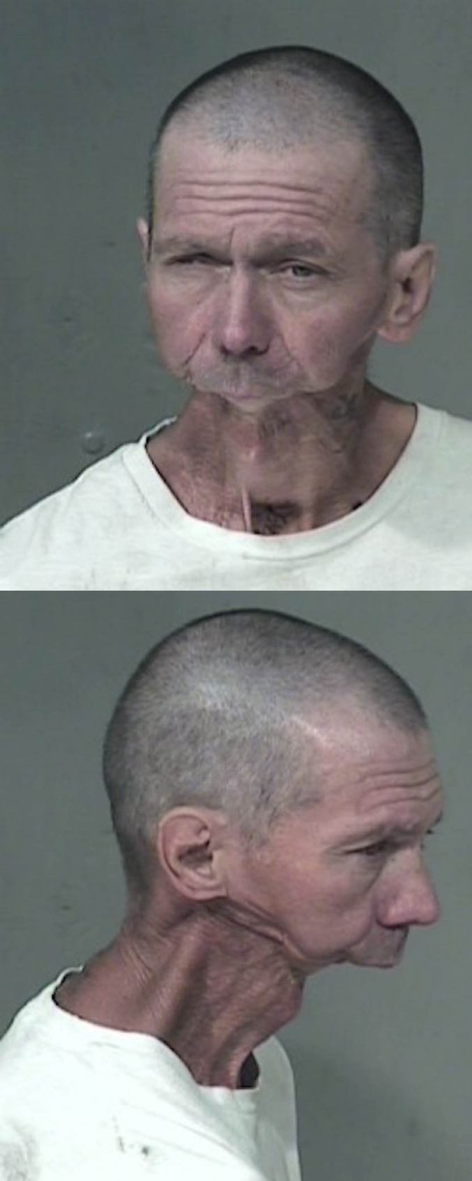 Un homme, dont la partie inférieure de sa bouche manquait, a été arrêté à Phoenix (Etats Unis) pour traffic de méthédrine (dérivé d'amphétamines).