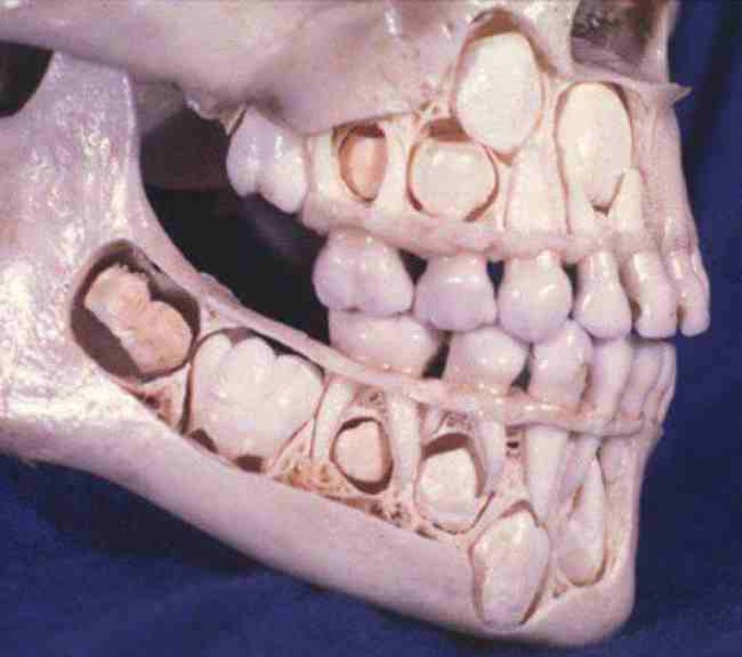 Crâne d’un enfant avant que celui-ci ne perde ses dents de lait, cool hein.