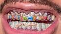 Les dents incroyables d'un croyant !