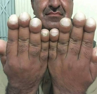 À votre avis est-ce dur de vivre avec ?