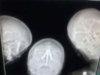 Selfie de radiologues