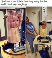 Radiographie pour bébé 