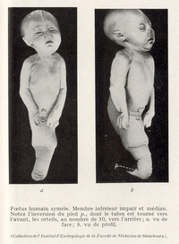 Comment sont les p'tits lombriks à la naissance