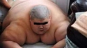 Quand tu es tellement obèse