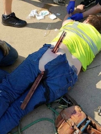 La barre de fer mal au cul