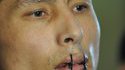 Bouche cousue