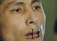 Bouche cousue