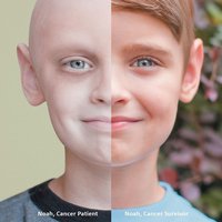 Noah, survivant du cancer: avant / après