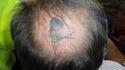 Tatouage chauve