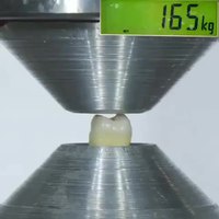 Selon vous combien de kilo de pression peut supporter une molaire?