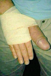 Un gros pouce, signe de validation