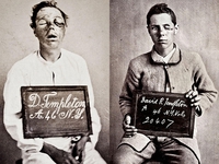 Soldat nordiste à son arrivée à l'hôpital et le même des mois plus tard