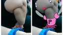 Gros bras