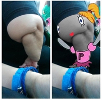 Gros bras