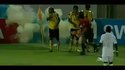 Un footballer qui a failli perdre sa main