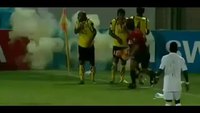 Un footballer qui a failli perdre sa main