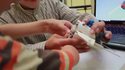 Une prothèse Lego pour enfant
