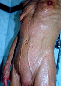 Avoir beaucoup de veines