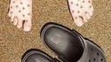 Quand tu as trop porté tes crocs au soleil