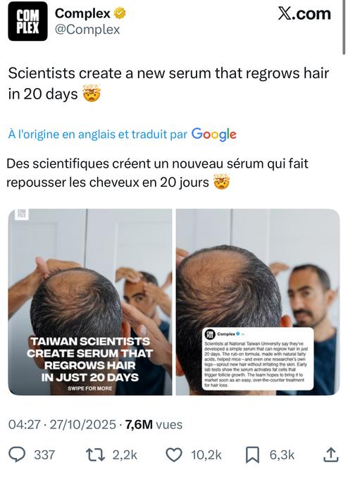 L’annonce diffusée par Complex s’appuie sur une recherche bien réelle menée à l’Université nationale de Taïwan (NTU), mais elle simplifie fortement les faits. Dans leur étude, les chercheurs ont expérimenté une formule à base d’acides gras naturels, appliquée localement sur la peau de souris dépourvues de poils. En une vingtaine de jours, ils ont observé une repousse dense et rapide. Le mécanisme proposé repose sur l’activation des cellules souches présentes dans les follicules pileux : selon eux, certains acides gras libérés lors de la dégradation des graisses sous-cutanées (comme l’acide oléique ou palmitoléique) “réveillent” ces cellules dormantes et relancent le cycle de croissance capillaire. Ce principe est intéressant, car il met en lumière le rôle du tissu adipeux dans la régénération des cheveux, un domaine longtemps négligé. Les chercheurs affirment même qu’un des membres de l’équipe aurait observé une repousse visible sur ses jambes après avoir testé le produit sur lui-même, ce qui a contribué à amplifier le retentissement médiatique de cette découverte.
Cependant, il faut rester prudent : ces résultats n’ont été confirmés que sur des modèles animaux et sur des follicules humains cultivés en laboratoire. Aucun essai clinique sur des volontaires humains n’a encore été publié. Les promesses de “repousse en 20 jours” concernent donc uniquement les souris, dont le cycle de croissance du poil est beaucoup plus court que celui du cheveu humain. En pratique, cela ne garantit ni la même rapidité, ni la même efficacité chez l’homme.
En ce qui concerne la nouveauté scientifique, cette approche est assez prometteuse car elle s’inscrit dans une piste relativement récente : celle du rôle métabolique des cellules graisseuses dans la régénération des tissus. D’autres équipes, notamment aux États-Unis et en Corée du Sud, avaient déjà observé que les adipocytes (cellules du tissu graisseux) peuvent libérer des signaux chimiques favorisant la croissance des follicules pileux, mais c’est la première fois qu’une étude semble démontrer un effet aussi rapide et mesurable via des acides gras précis appliqués directement sur la peau. Cela en fait une découverte originale et crédible, d’autant plus qu’elle ne passe pas par des médicaments hormonaux ou des greffes, mais par un processus naturel de régénération tissulaire.
Autrement dit, cette recherche n’est pas un simple coup médiatique : le concept repose sur des bases biologiques solides et pourrait, s’il est confirmé par des essais cliniques, ouvrir une nouvelle voie thérapeutique dans la lutte contre la calvitie. Toutefois, on en est encore loin d’un produit prêt à la commercialisation. Les chercheurs eux-mêmes évoquent une phase de plusieurs années avant d’envisager des tests cliniques et une mise sur le marché. En somme, il ne s’agit pas d’un “remède miracle” imminent, mais d’une piste scientifique réellement prometteuse, fondée sur une compréhension innovante du rôle du tissu adipeux dans la croissance capillaire.