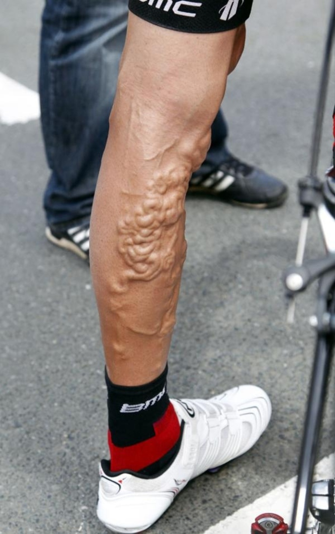 La jambe de Georges Hincapie, cycliste  américain.