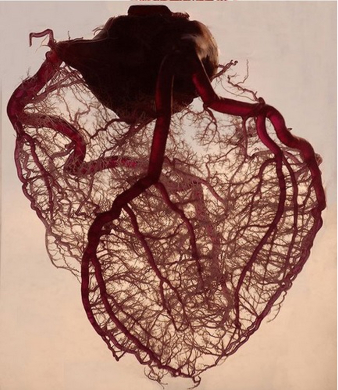 Une magnifique représentation des artères du cœur. On voit bien se détacher de la base de l'aorte les deux artères coronaires, avec l'artère coronaire droit qui vascularise la partie droite du cœur et se porte vers l'arrière et l'artère coronaire gauche qui se divise en artère inter-ventriculaire et artère circonflexe... Quoi, OSEF ? Ok, bonne journée !