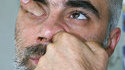 Doigt dans l'oeil