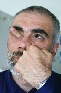 Doigt dans l'oeil