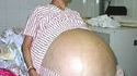 Femme enceinte