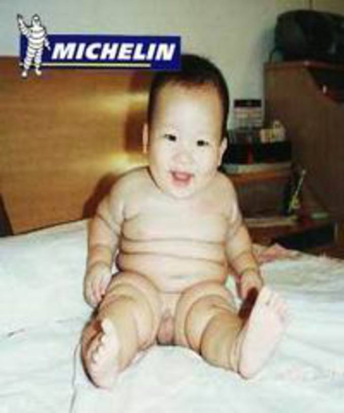 Un bébé digne de Michelin.