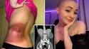 Onlyfans et cancer 