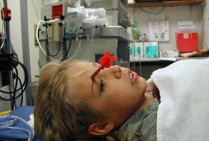 Un enfant avec une flechette plantée dans le crâne.