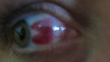 Pac-Man eye