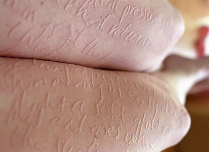 Une résidente de Chengdu souffre d'une maladie qui lui permet d'utiliser sa peau tel un pense-bête en papier.