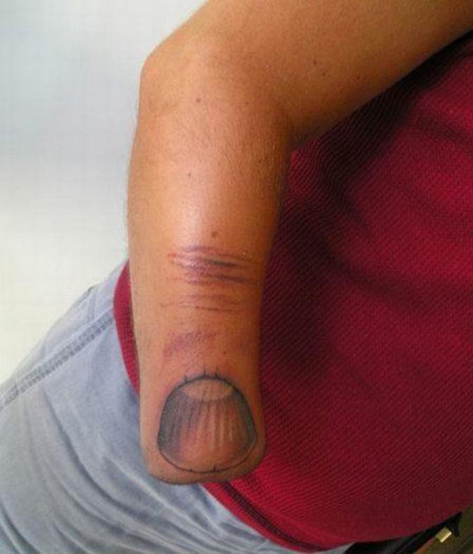 Un tatouage sur un bras amputé.