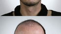 Portraits génétiques