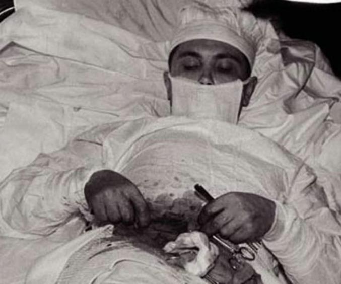 c’était un médecin soviétique confronté à une situation de vie ou de mort en Antarctique en 1961. Il était le seul médecin de la station Novolazarevskaya, où il a développé une appendicite aiguë. N'ayant pas d'autre choix, il a décidé de s'opérer lui-même.
Il a préparé une salle d'opération de fortune avec une table, un miroir et quelques instruments. Il avait deux assistants qui lui remettaient les outils et tenaient le miroir. Il a utilisé une anesthésie locale et un scalpel pour pratiquer une incision dans son abdomen. Il a ensuite soigneusement retiré son appendice, qui était enflammé et sur le point d'éclater.
L'ensemble de l'opération a duré environ deux heures. Il a réussi à recoudre la plaie et à appliquer un pansement. Il écrivit plus tard dans son journal :
"Je travaillais sans gants. C'était difficile de voir. Le miroir aide, mais il gêne aussi : après tout, il montre les choses à l'envers."
Il a survécu et s'est complètement rétabli en deux semaines.