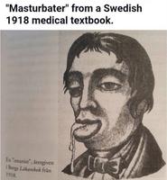 Illustration d'un livre de médecine suédois de 1918 : Le masturbateur