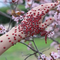 Coccinelles
