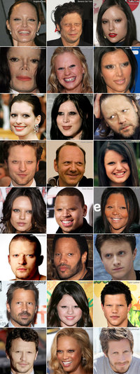 Célébrités sans sourcils
